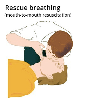 mouth-to-mouth resuscitation applied in first aid support to help the victim start breathing